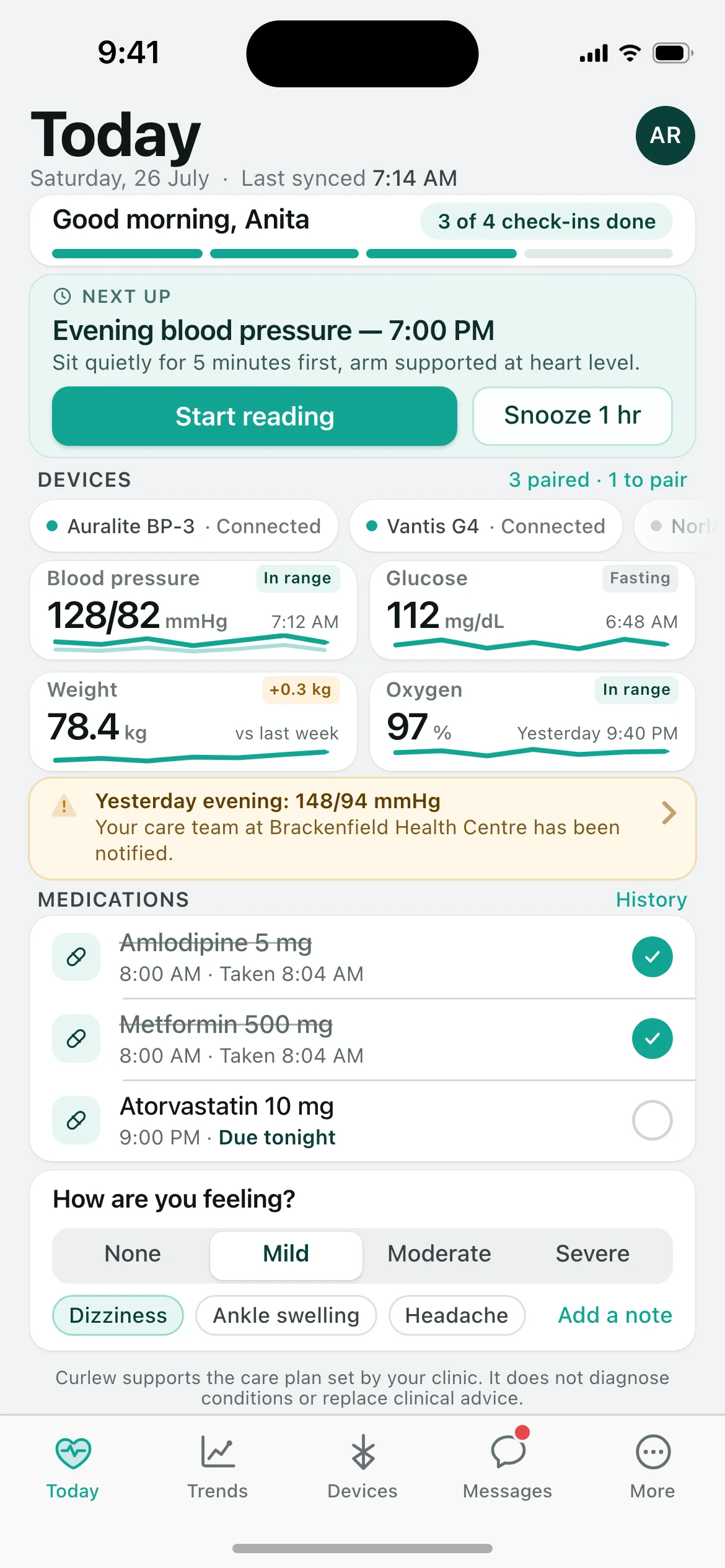 Curlew — the Today screen, running on iOS